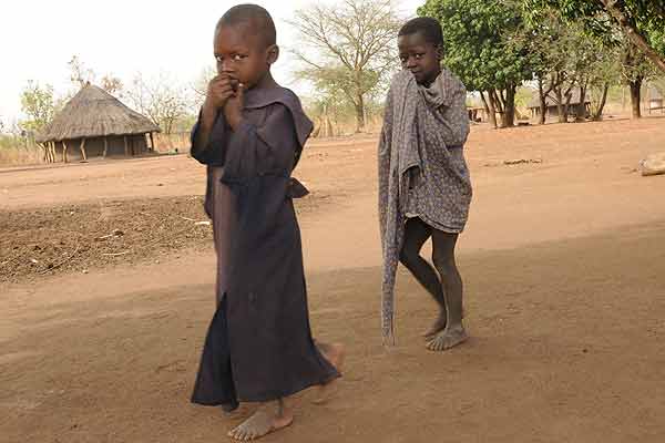Síndrome del cabeceo, el extraño mal de los niños en Uganda