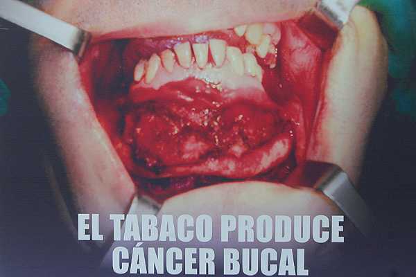 tabaco-publicidad-el-mer_135012-L0x0.jpg